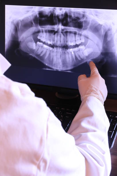 Best Same-Day Emergency Dental Services in Cavalier, ND